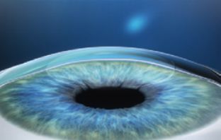 Augen lasern