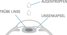 Lasertechnologie